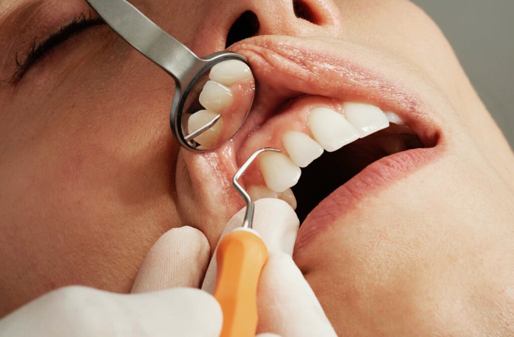 Limpeza dentária profissional e profilaxia em Curitiba - Dr. Rullian Pinheiro